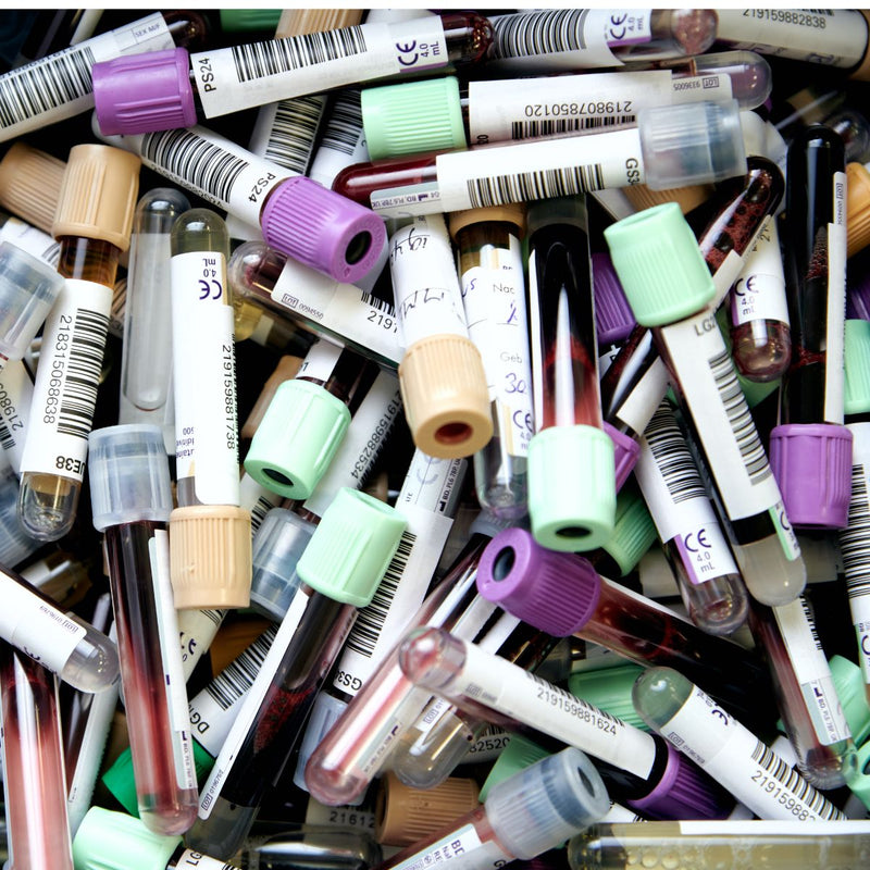 Are microplastics really in 80% of human blood?